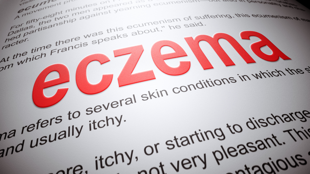 Eczema - What to Use or Avoid. All Questions Answered Here!